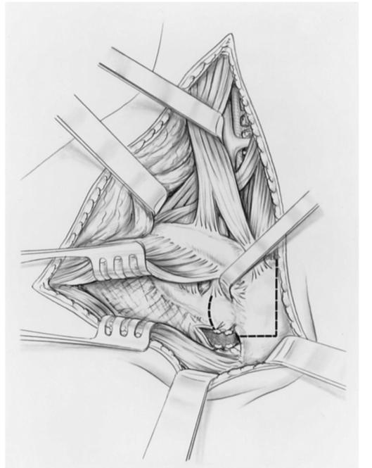 Descriptive text is not available for this image