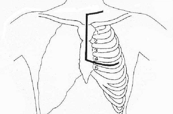 Descriptive text is not available for this image