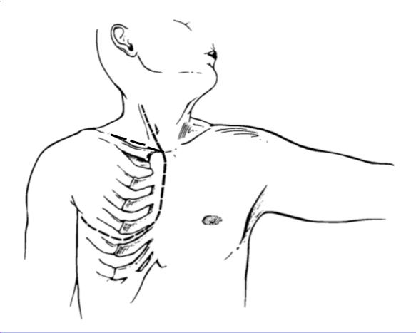 Descriptive text is not available for this image