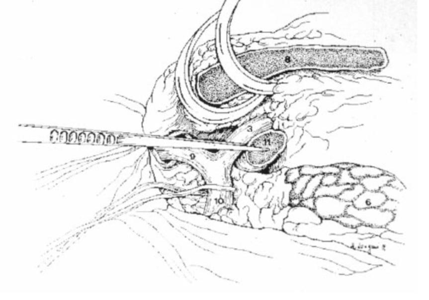 Descriptive text is not available for this image