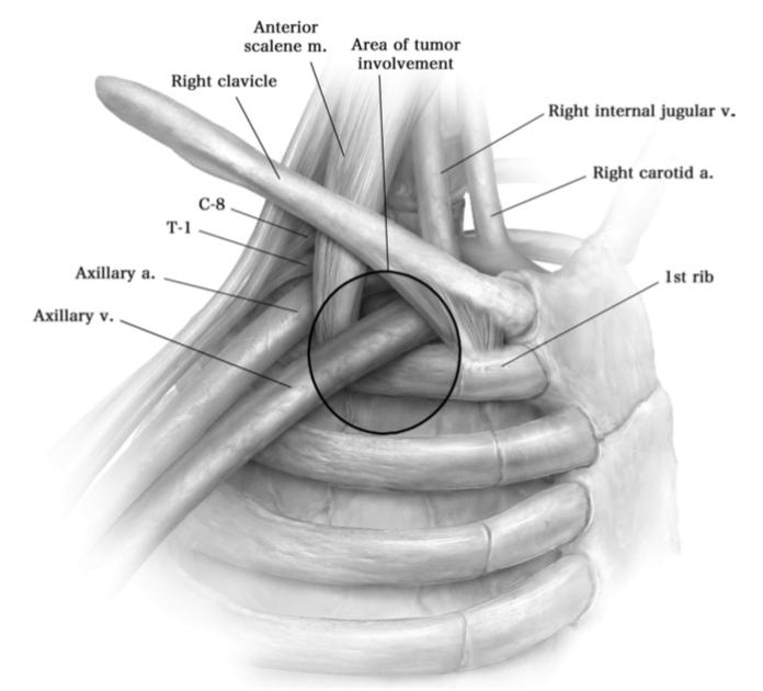 Descriptive text is not available for this image