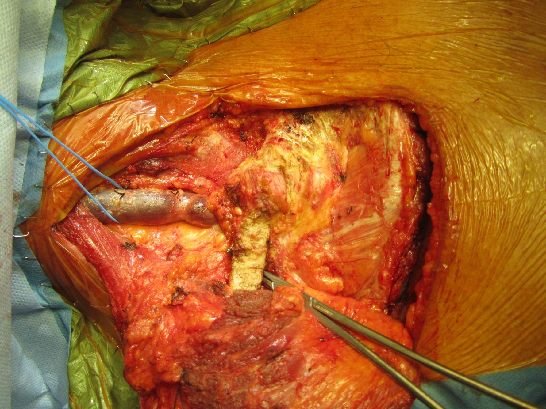 Descriptive text is not available for this image