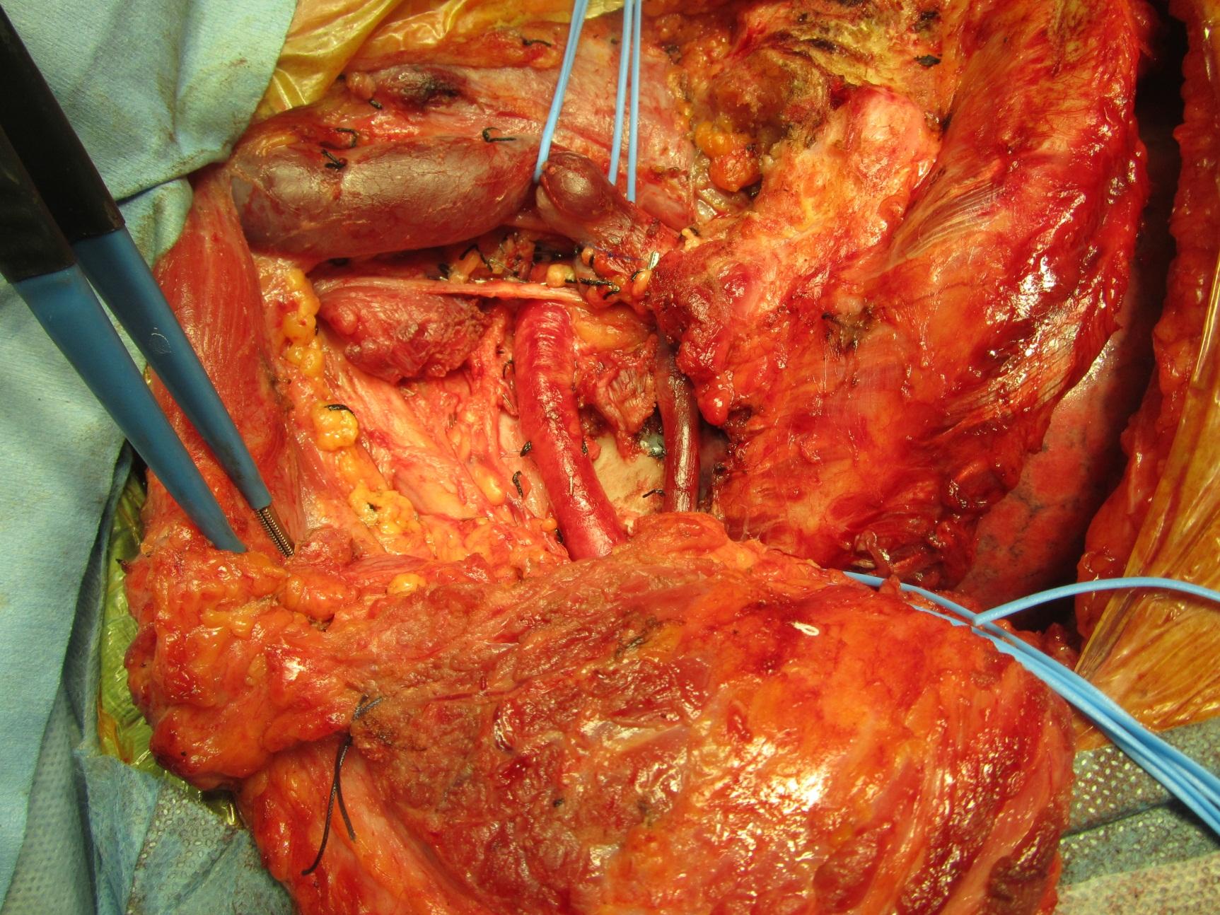 Descriptive text is not available for this image